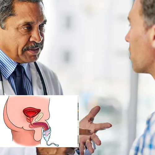 Welcome to   Greater Long Beach Surgery Center 
: Your Trusted Guide on Penile Implants